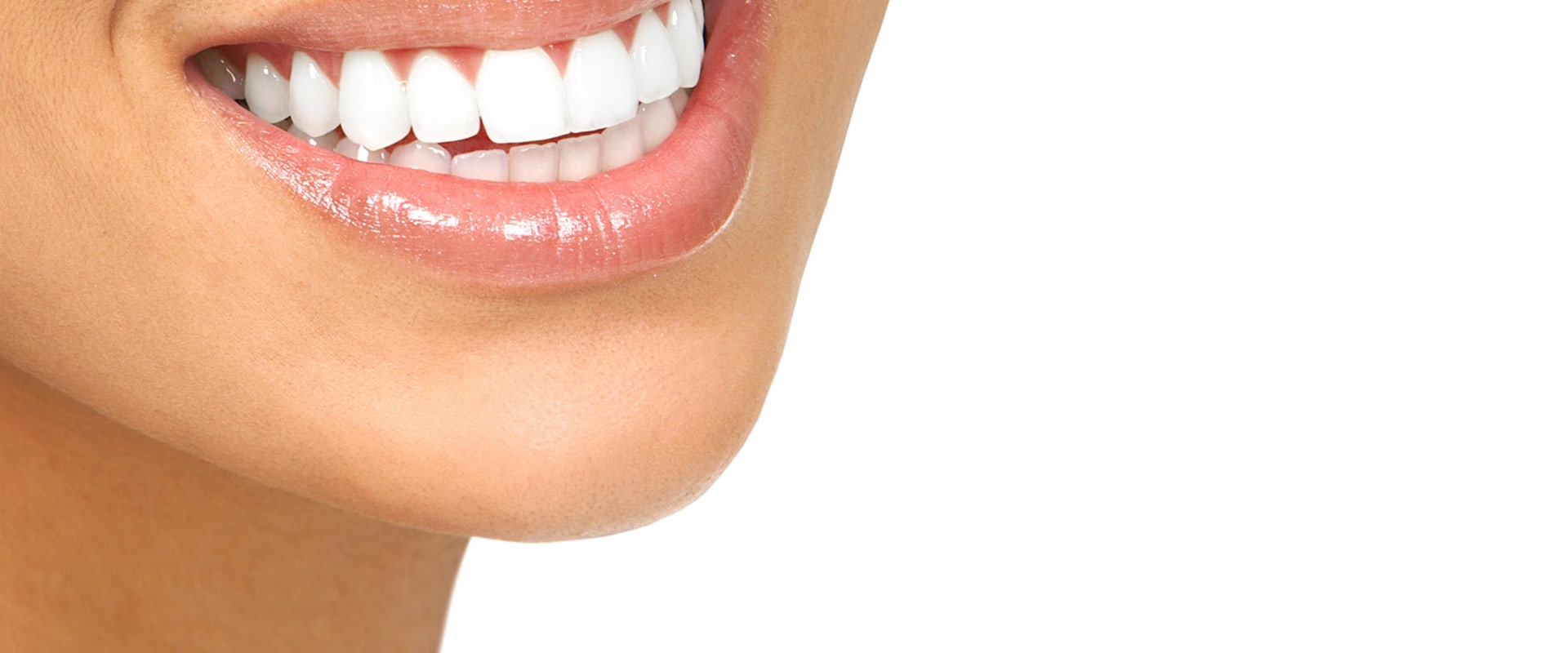 Bexley Smile Makeovers Transforming Your Teeth And Boosting Your