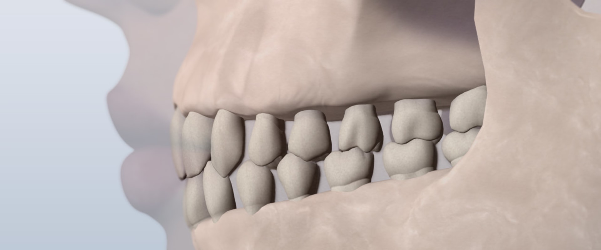 What are the three classifications of orthodontic treatment?