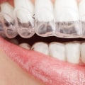 What are non cosmetic dental treatment?