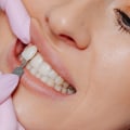 Experience The Benefits Of Top Cosmetic Dentistry In Woden: What You Need To Know