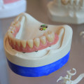 Understanding The Importance Of Dental Implants In Mission Viejo Cosmetic Dentistry
