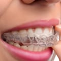 What is the difference between cosmetic braces and authentic braces?