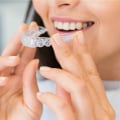 Transform Your Smile With Invisalign In San Antonio: The Ultimate Guide To Cosmetic Dentistry