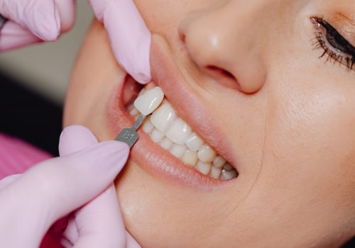 Experience The Benefits Of Top Cosmetic Dentistry In Woden: What You Need To Know