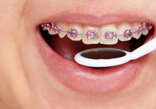 What are the different types of orthodontic treatments?