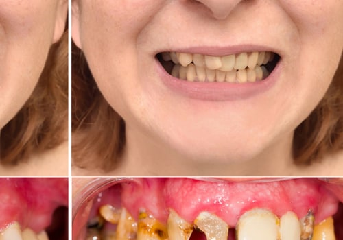 What options are there for perfect teeth?