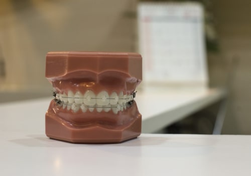 What procedures are considered orthodontia?
