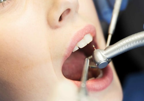 What is the most popular dental procedure?