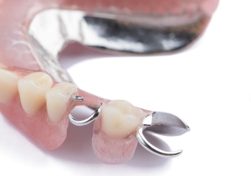 What is the difference between cosmetic dentures and regular dentures?