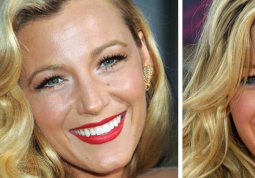 How do celebrities get nice teeth?