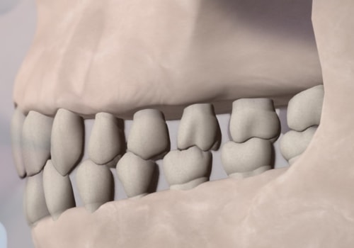 What are the 3 categories of orthodontics?