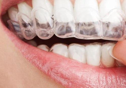 What are non cosmetic dental procedures?